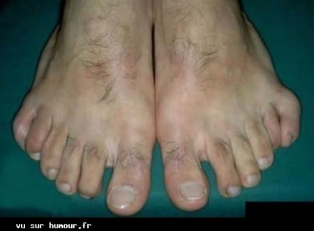 combien avez-vous de doigt de pieds? lol
